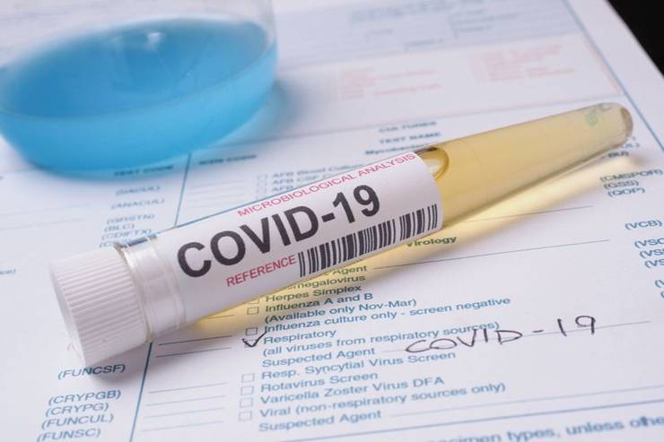 Coronavirus: 1.104 cazuri noi în ţară. Alte nouă persoane infectate în judeţul Hunedoara